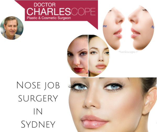 nose- job-Sydney